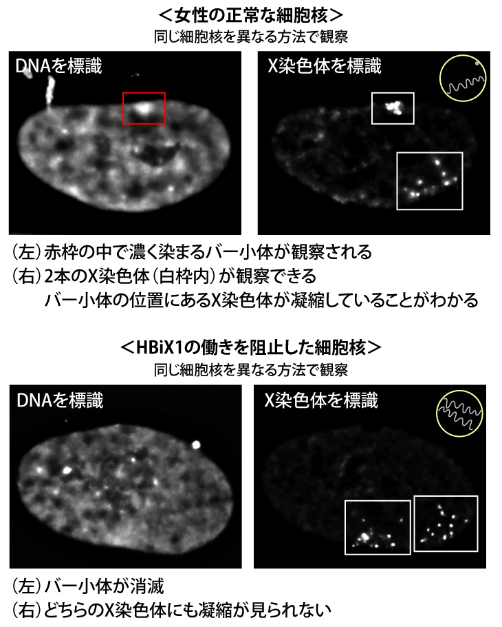 HBiX1タンパク質はバー小体形成を担う